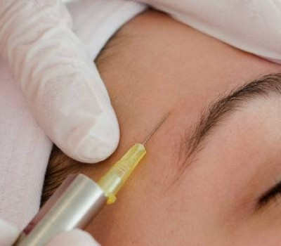 Bioskinjetting